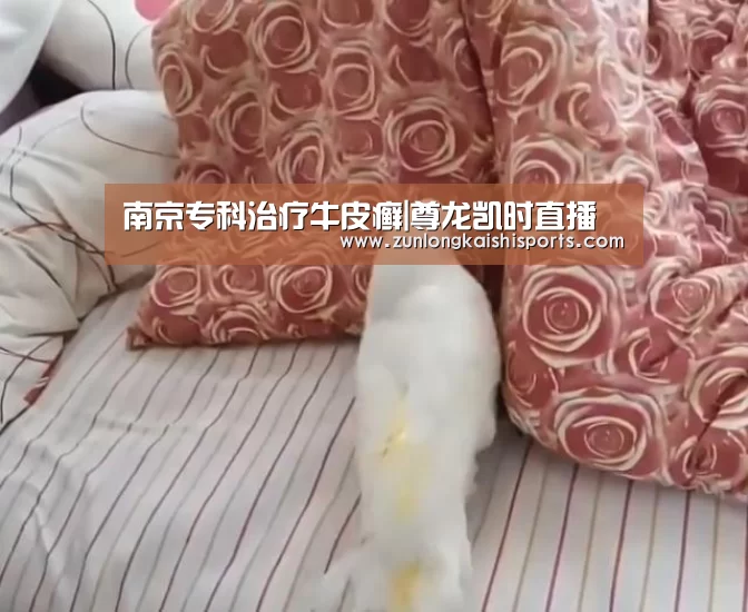 南京专科治疗牛皮癣|尊龙凯时直播(图3) 尊龙凯时直播